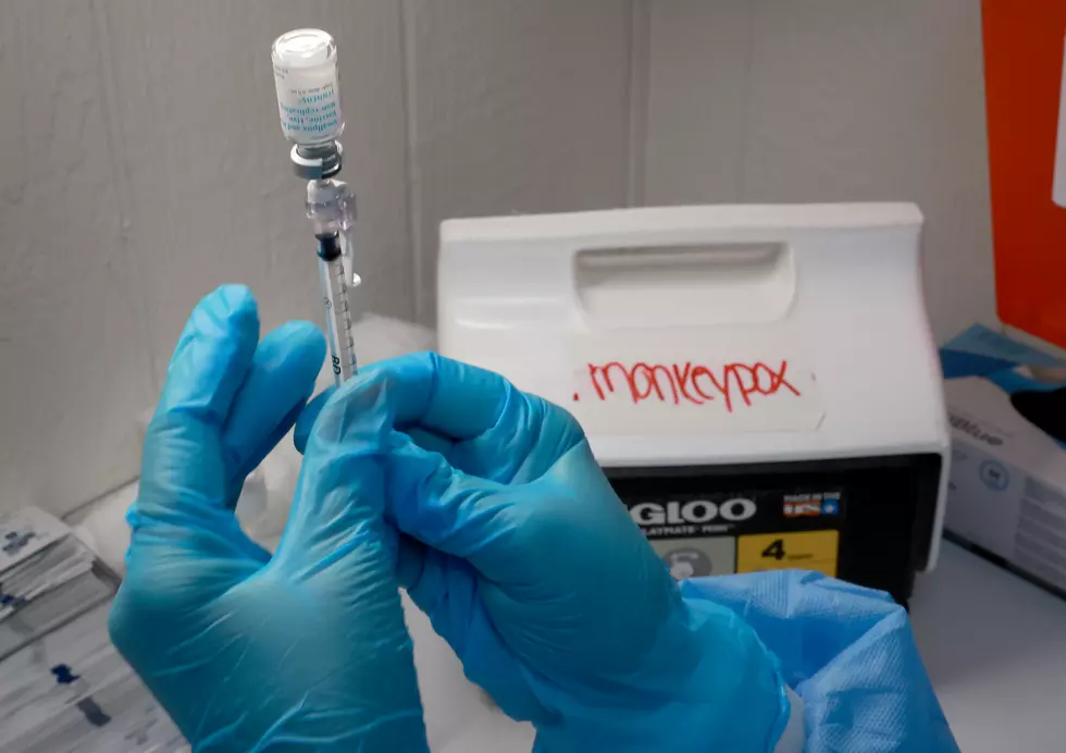Case of Monkeypox Confirmed in Oneida County